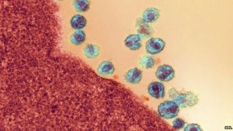 Virus HIV tiềm ẩn có thể được kích hoạt bằng một loại thuốc chống ung thư.