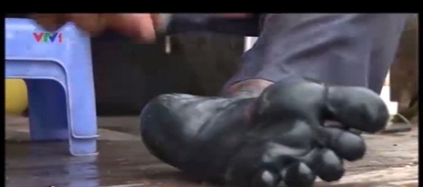 Người dân cho biết, bàn chân không chỉ bị đen mà còn ngứa ngáy, dùng chanh và xà bông rửa cũng không sạch. (Hình ảnh cắt từ clip của VTV)