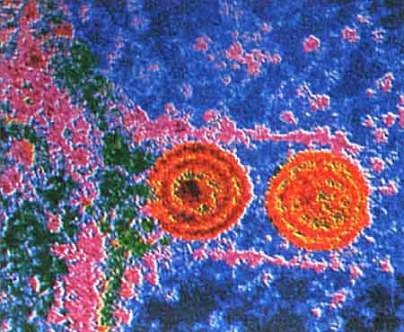 Virus HPV.