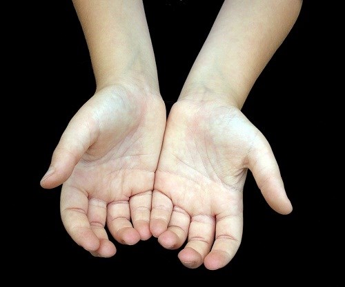 
Tay của bạn có màu gì khi mở lòng bàn tay ra sau 30 giây nắm chặt? (Ảnh: Internet)
