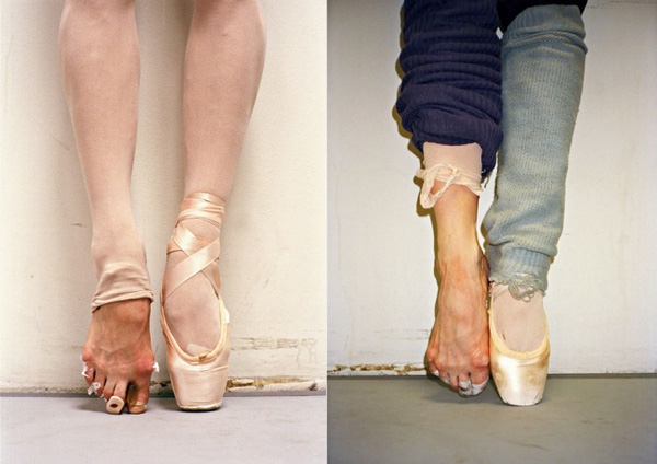 
Đôi chân xấu xí của những vũ công ballet.
