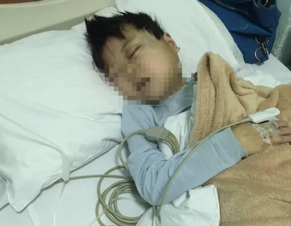 
Cậu bé 9 tuổi nằm trong bệnh viện với đôi mắt sưng vù sau khi bị giáo viên tát.
