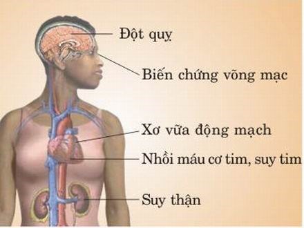 
Hình ảnh tổn thương đa tạng do tăng huyết áp
