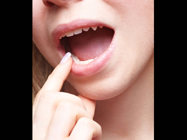 
Miệng: Nếu bạn đang bị đau miệng trên 2 tuần, hãy tới nha sĩ hoặc bác sĩ da liễu của bạn ngay lập tức. Miệng có thể là một trong những nơi bất ngờ nhất mà bạn có thể bị ung thư. 
