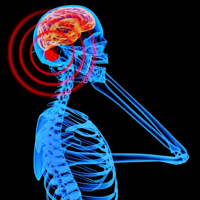 Kết luận khoa học: Điện thoại di động không gây ung thư não - Ảnh 1.