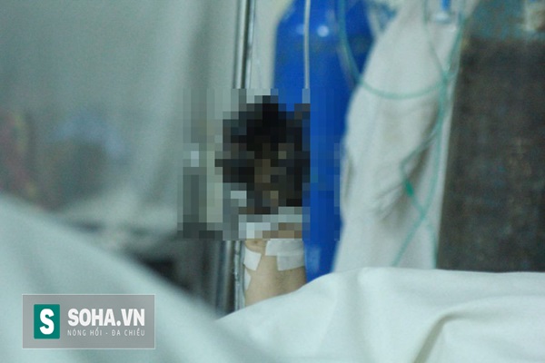 
Một cánh tay của bệnh nhân bị nhựa đường dính đen hiện đang được điều trị tại Bệnh viện Đa khoa huyện Tân Lạc.
