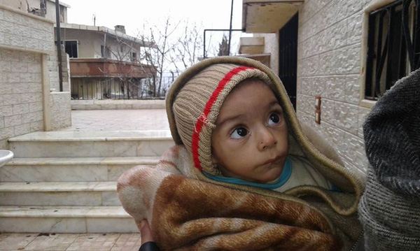
Một em nhỏ khác ở thị trấn Madaya với gương mặt xanh xao, yếu ớt.
