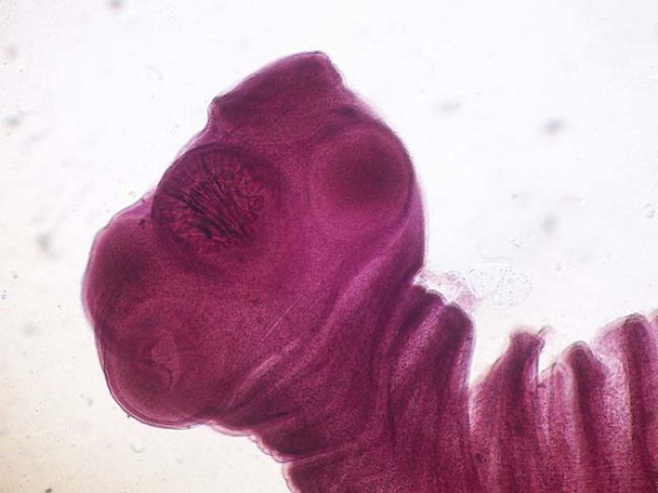 
Khuôn mặt kinh dị của loài sán dây dưới kính hiển vi.
