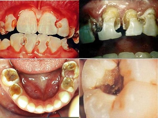 
Nhìn những hình ảnh này, bạn còn muốn hút thuốc lá nữa?
