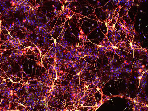 Nơ-ron thần kinh được tạo ra từ tế bào gốc phát triển từ các tế bào da