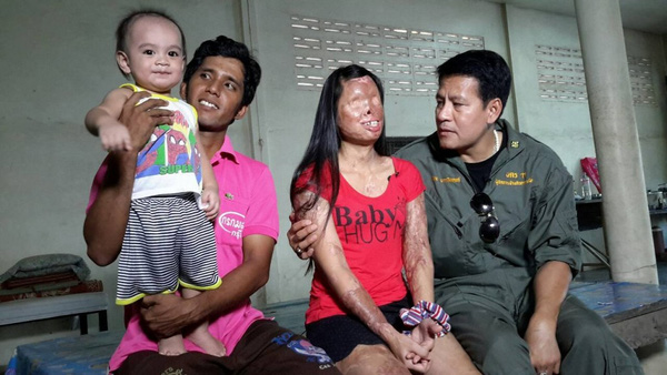 
Gia đình cô gái được nam diễn viên Thái Lan Bin Bunluerit thăm hỏi động viên.
