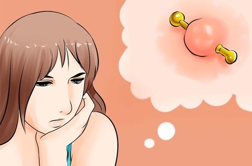 Xỏ khuyên có thể khiến bạn nhiễm virus viêm gan B, C... (Ảnh: Wikihow)