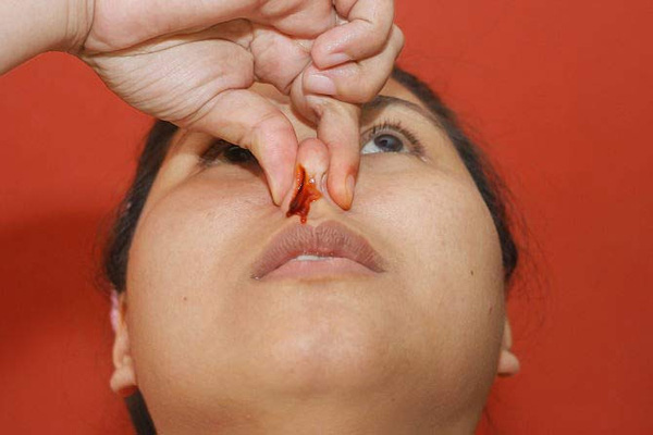 
Việc ngoáy mũi cũng khiến cho các mạch máu ở mũi bị tổn thương sinh ra chảy máu mũi và rất khó cầm máu...
