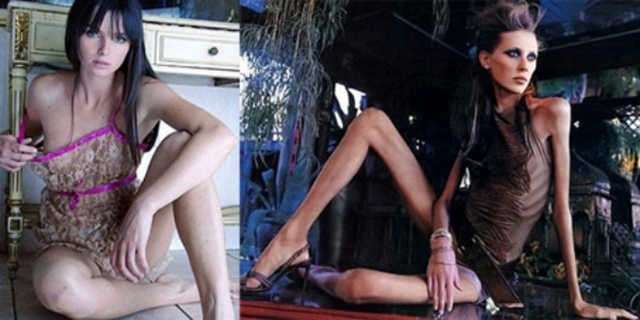 
Ana trước và sau khi làm người mẫu.
