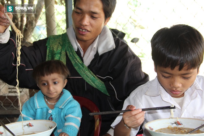 
Rể ăn rất ít, mỗi bữa em chỉ ăn khoảng 1 chén cơm. Anh An cho biết đã nhiều lần đến các bệnh viện chữa trị cho con nhưng không được.
