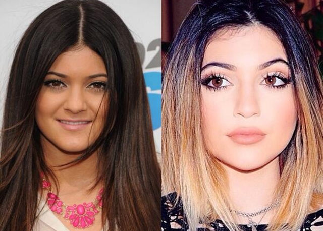 
Kylie của năm 2013 và bây giờ.
