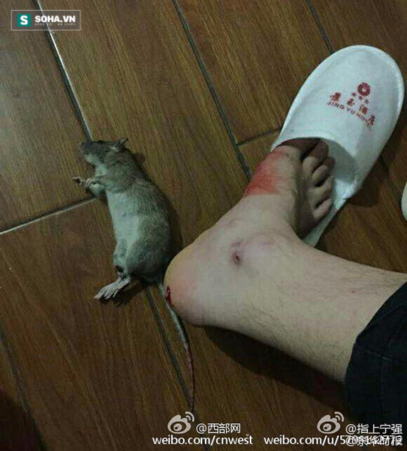 
Hình ảnh được nạn nhân bị chuột cắn đăng tải lên mạng để bày tỏ sự bức xúc đối với dịch vụ của khách sạn Cảnh Ngọc.
