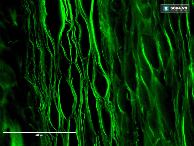 
Hình ảnh lụa fibroin dưới kính hiển vi.

