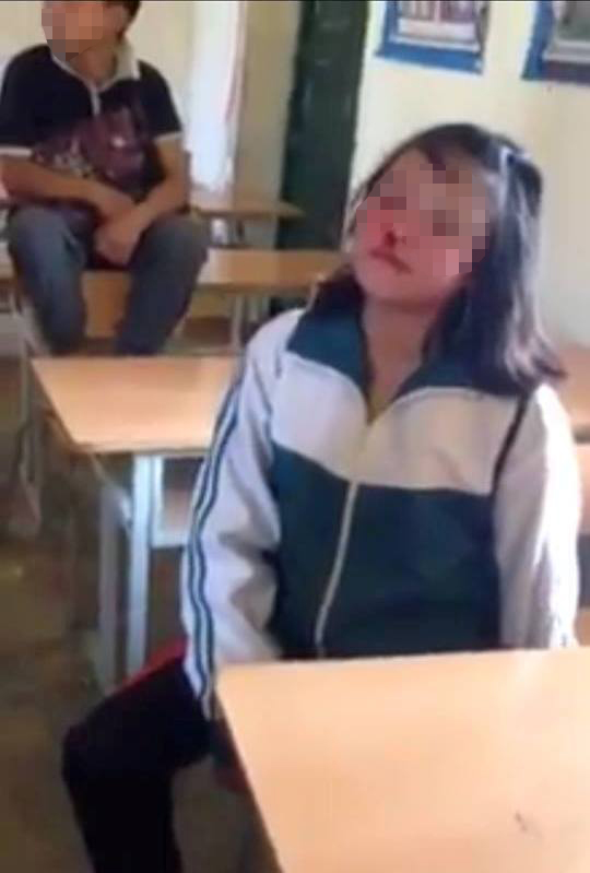 
Nữ sinh bị tát chảy máu mũi nhưng không có học sinh nào can ngăn. (Ảnh cắt từ clip)
