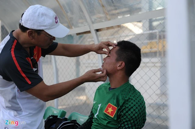 Thủ môn số 1 của U19 VN bị đau mắt trước trận gặp Hàn Quốc