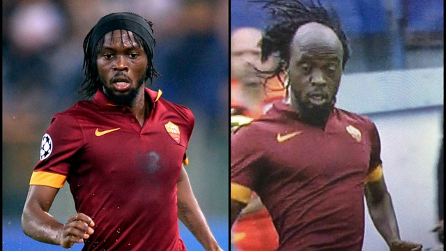 Khuôn mặt không có khăn che đầu của Gervinho trông vô cùng gớm ghiếc