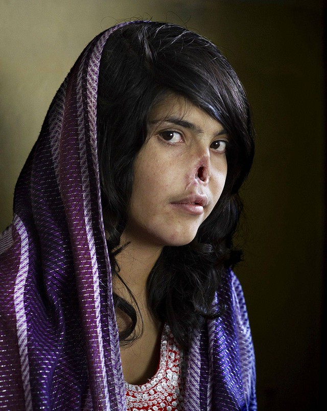 Bibi Aisha, cô gái trẻ người Afghanistan, 18 tuổi, đã phải gánh chịu một bi kịch khủng khiếp khi bị chồng cắt cả hai tai và mũi theo lệnh của Taliban. Khi phóng viên tờ Time (Mỹ) đề nghị cô chụp ảnh để đưa lên trang bìa tạp chí này, Aisha theo thói quen bất ngờ đưa tay lên che mặt. Tuy nhiên, khi hiểu được ý nghĩa tố cáo của bức ảnh cô đồng ý chụp với lời giải thích: &quot;Tôi không biết điều đó có giúp được gì cho những phụ nữ khác hay không. Đơn giản tôi chỉ muốn có lại một chiếc mũi.