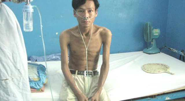 Anh Nguyễn Thái Bằng đang điều trị tại Bệnh viện Phạm Ngọc Thạch, TP.HCM.