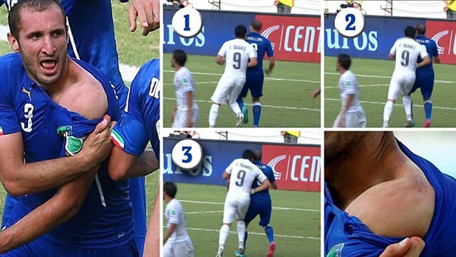 Những hình ảnh chứng minh hành động cắn vào vai đối phương của Suarez