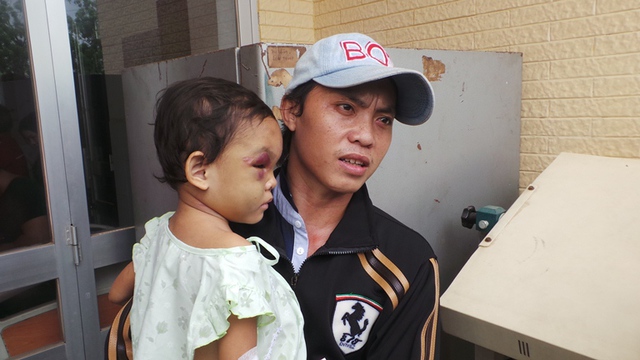 Biết tin con gái bị mẹ và cha dượng bạo hành anh Trần Văn Tố đã đến bệnh viện Đa khoa tỉnh Bình Dương nhận là cha ruột bé Ngân