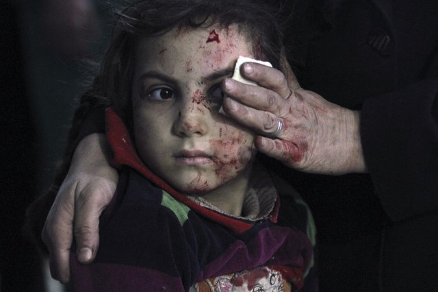 Bà mẹ dùng khăn lau mặt cho cô con gái bị thương tại một bệnh viện dã chiến. Cô bé bị thương trong cuộc không kích của quân đội chính phủ nhằm vào thành phố Damascus, Syria.