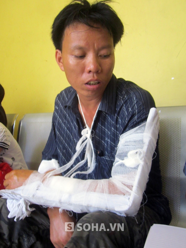 Anh Hùng bị 3 đối tượng dùng dao chém đứt gân 2 cánh tay và mẻ xương hiện đang điều trị tại bệnh viện đa khoa TP Vinh (Nghệ An).