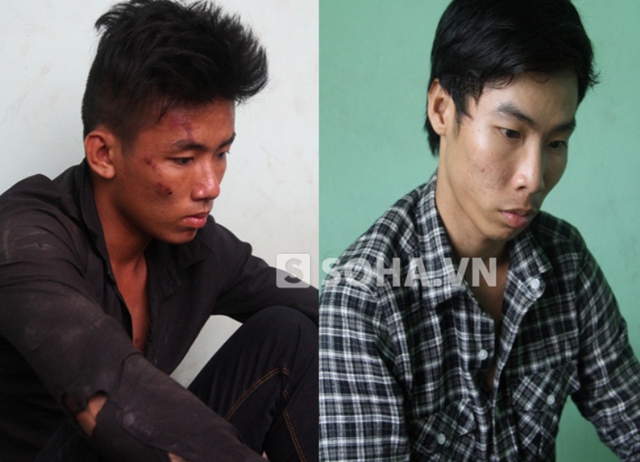 Hai tên cướp táo tợn giữa Sài Gòn khiến cô gái trẻ chấn thương sọ não