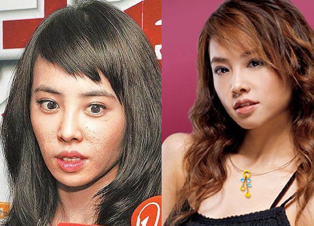 Nữ ca sĩ Thái Y Lâm khiến người hâm mộ khóc thét vì làn da đầy mụn khi không trang điểm và photoshop.