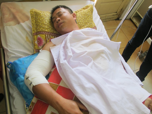 Hiện tại tài xế Ninh đã được phẫu thuật gắp những mảnh vỡ ra khỏi vùng chấn thương ở cánh tay.