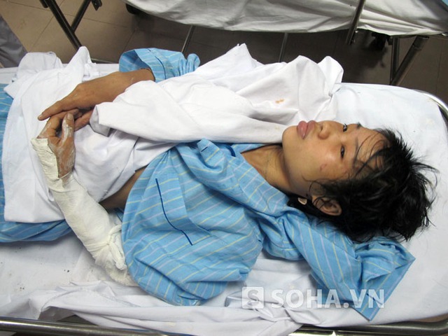 Vụ tai nạn khiến chị Lang Thị Kim bị gãy tay, đa chấn thương ở người.