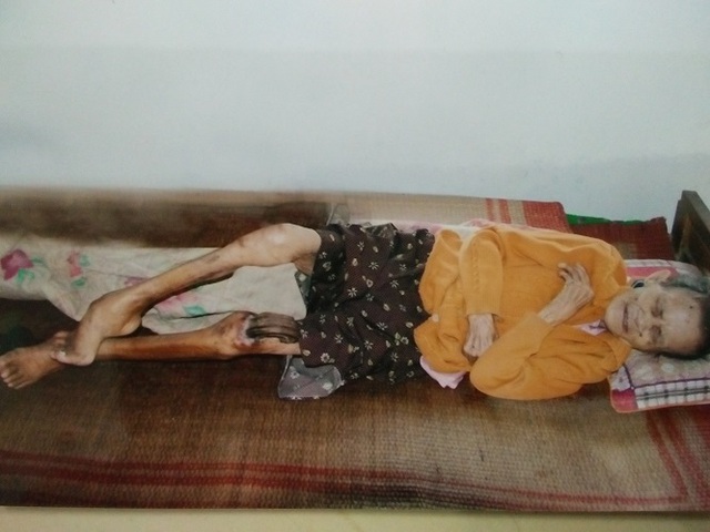 Sừng cong vút mọc ở chân, cụ bà người Nam Định thọ gần 100 tuổi - Ảnh 1