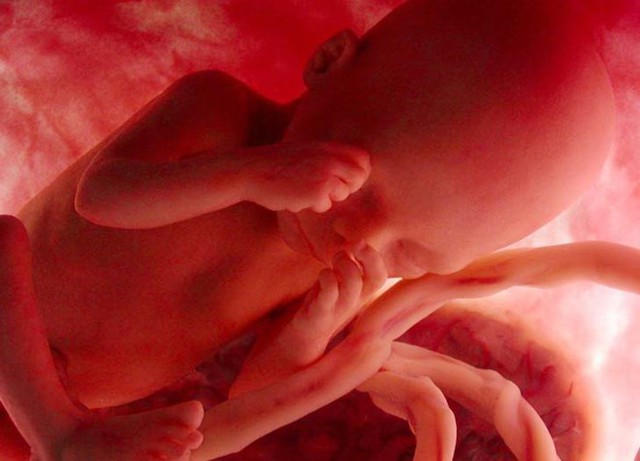 
Nhiều ý kiến cho rằng các bào thai cũng có quyền của con người
