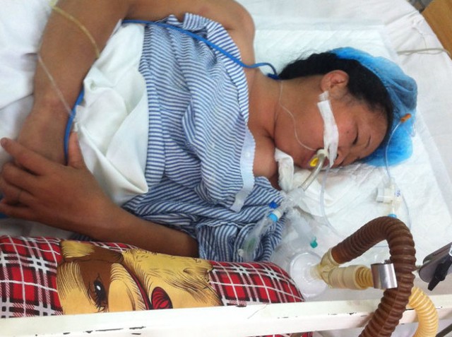 Bệnh nhân Năm liệt toàn thân đang điều trị tại trung tâm chống độc Bệnh viện Bạch Mai - Ảnh: Bệnh viện cung cấp