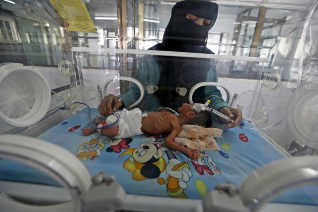 Bác sĩ chăm sóc một em bé sơ sinh trong lồng kính tại bệnh viện ở Sanaa, Yemen.
