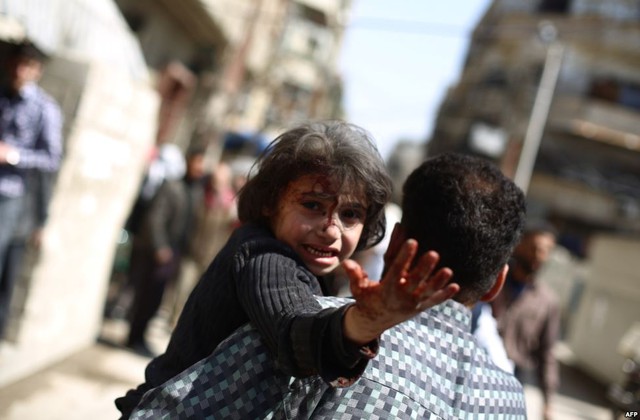 Người đàn ông bế em bé bị thương trong vụ không kích của quân đội chính phủ nhằm vào thành phố Damascus, Syria.