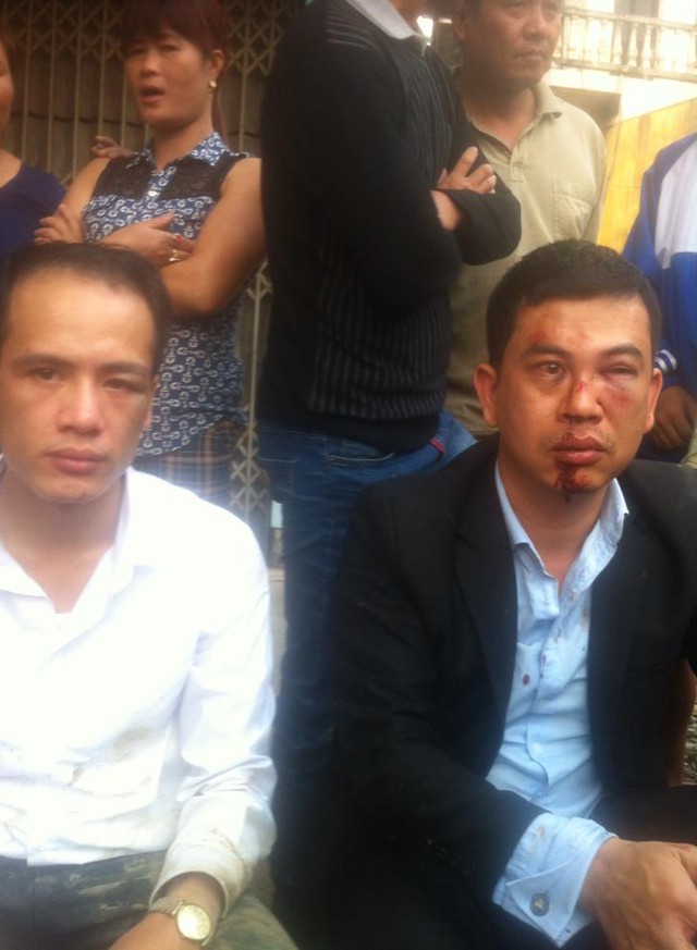 
Luật sư Trần Thu Nam và luật sư Lê Luân sau khi bị hành hung tại xã Đông Phương Yên (huyện Chương Mỹ, Hà Nội) vào chiều 3/11. Ảnh: Facebook luật sư Trần Thu Nam
