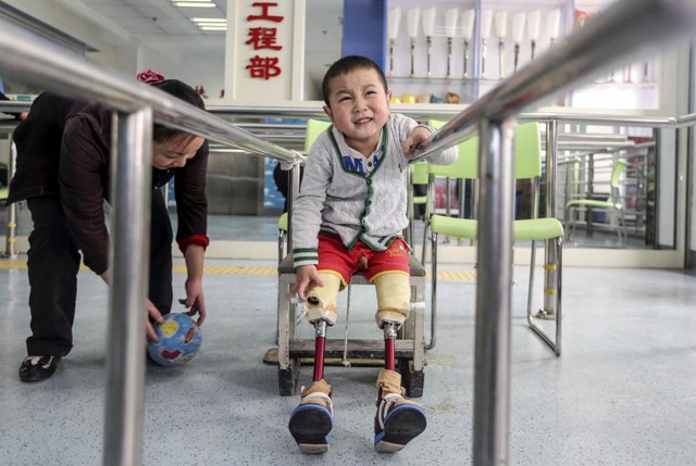 Cậu bé hai tuổi nhăn mặt khi tập đi bằng đôi chân giả tại một bệnh viện ở thành phố Vũ Hán, Trung Quốc. Cậu bé bị mất đôi chân trong một tai nạn giao thông đầu tháng này.