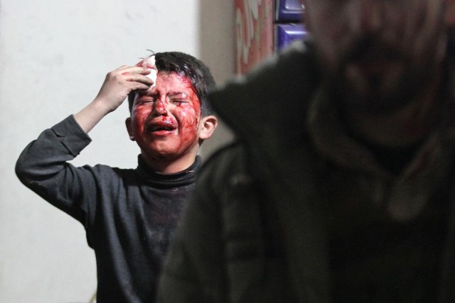 Một cậu bé bị thương trong cuộc không kích của quân đội chính phủ Syria vào thành phố Damascus.