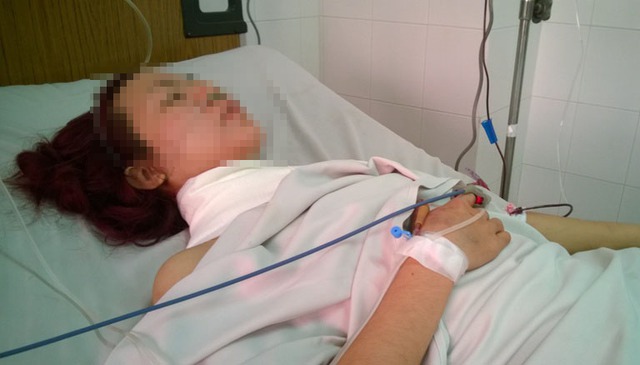 Nạn nhân Trịnh Thị T. đang được điều trị tại bệnh viện Trưng Vương