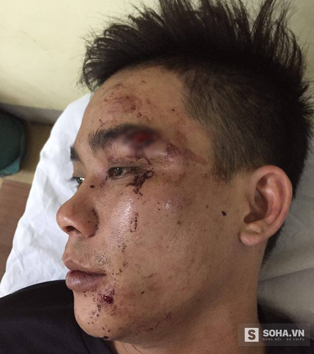 
Bị hành hung, anh Hương bị đa chấn thương và được đưa vào bệnh viện cấp cứu.
