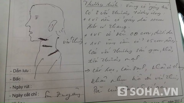 Sơ đồ phác họa vết thương của cháu Đào Thị T.