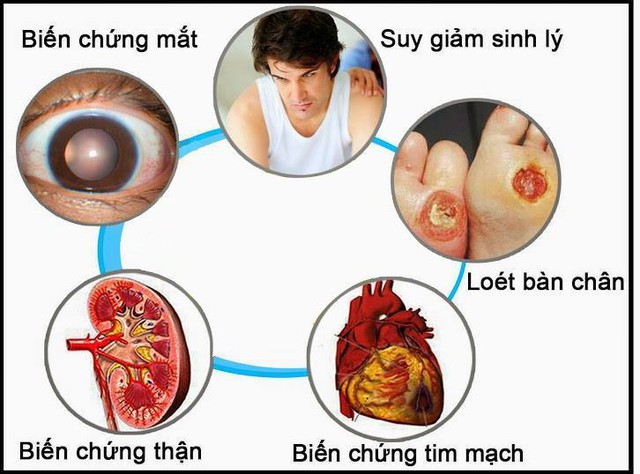 Những biến chứng nguy hiểm của bệnh tiểu đường.