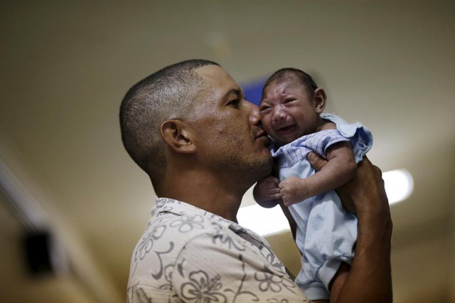Người đàn ông bế con nhỏ bị mắc chứng đầu nhỏ tại bệnh viện Oswaldo Cruz ở Recife, Brazil.