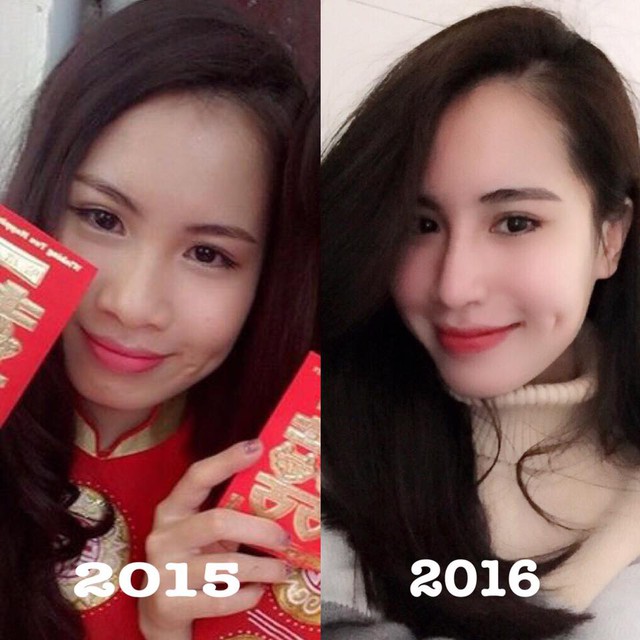 
Hình ảnh trước và sau khi phẫu thuật thẩm mỹ của Hạ Linh
