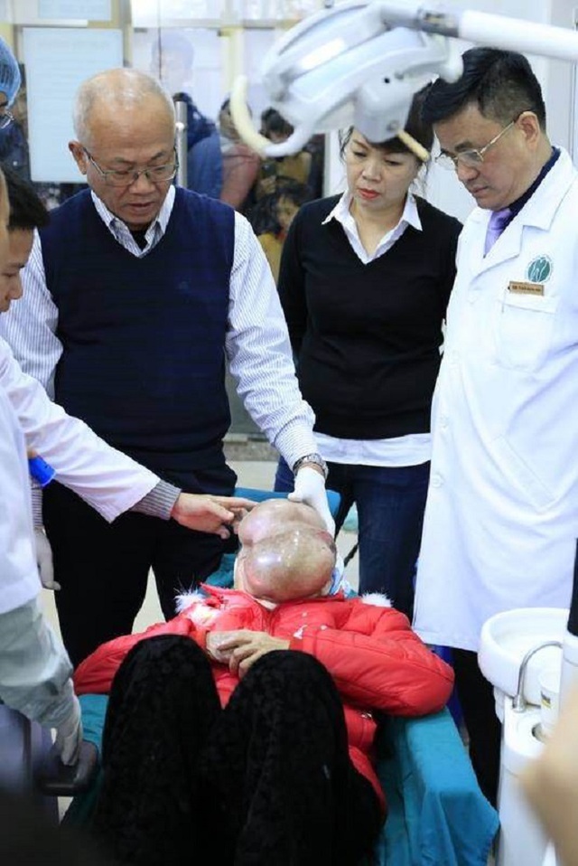
Bệnh viện RHMTW đã phối hợp với các Giáo sư, Bác sỹ chuyên khoa sọ não, của Bệnh viện Việt Đức Hà Nội thực hiện ca phẫu thuật này.
